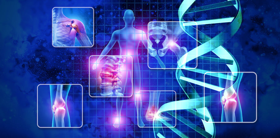 Arthritis Awareness Month: A Guide to Living With Arthritis