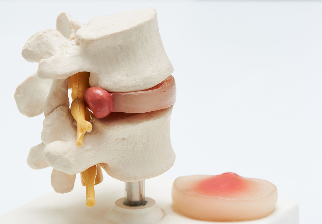 how to prevent a herniated disc in the spine