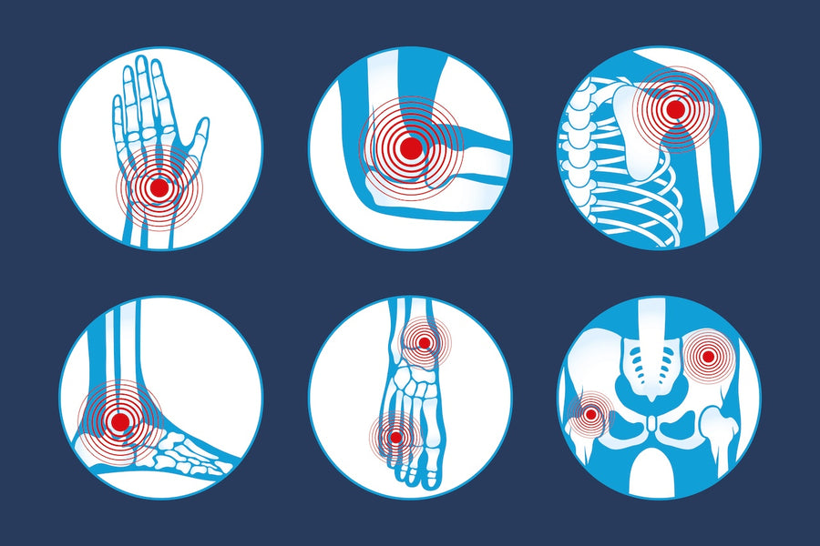 Creating Routines For Rheumatoid Arthritis Self-Care At Home