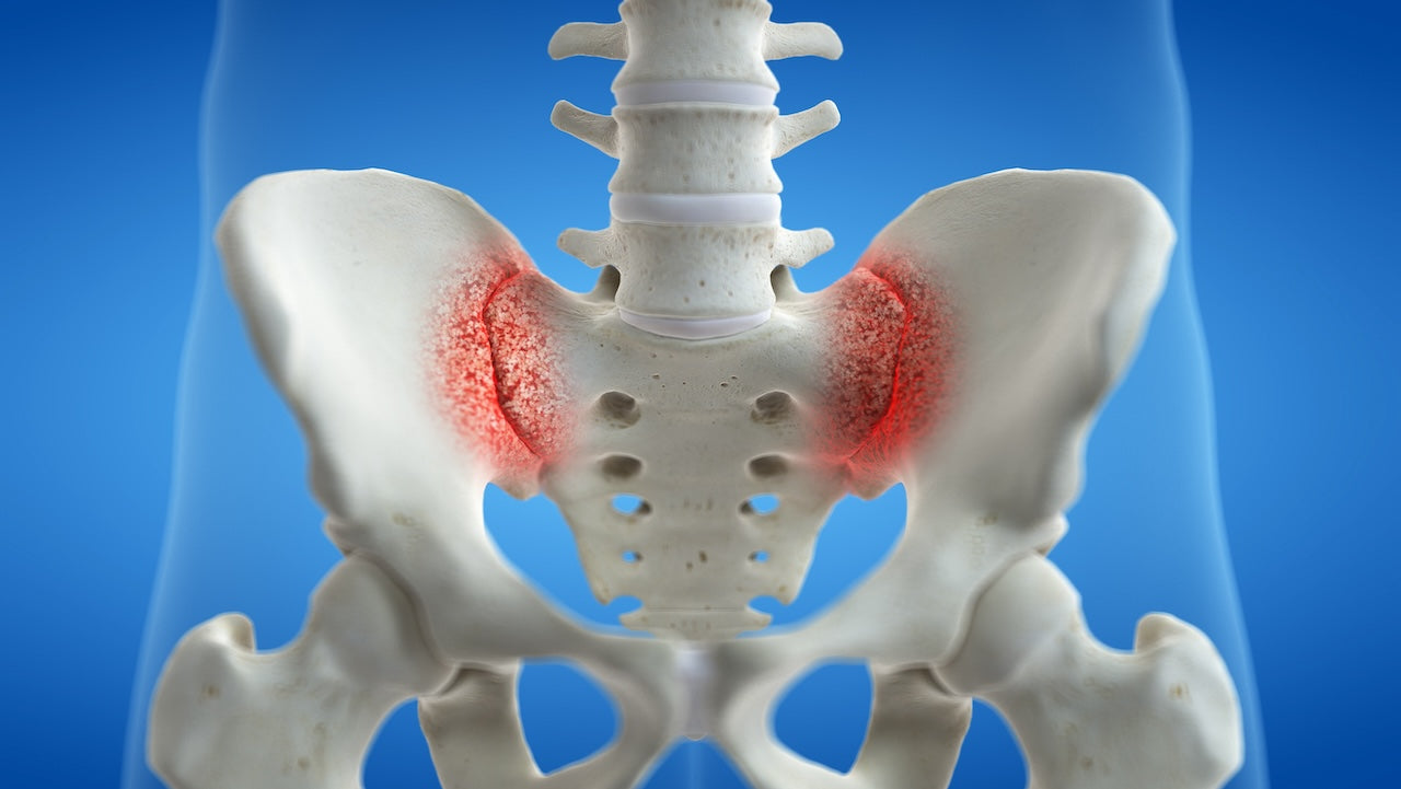 si-joint-pain-relief