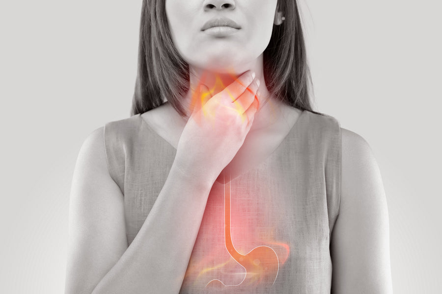 How to Prevent Heartburn With Simple Lifestyle Changes