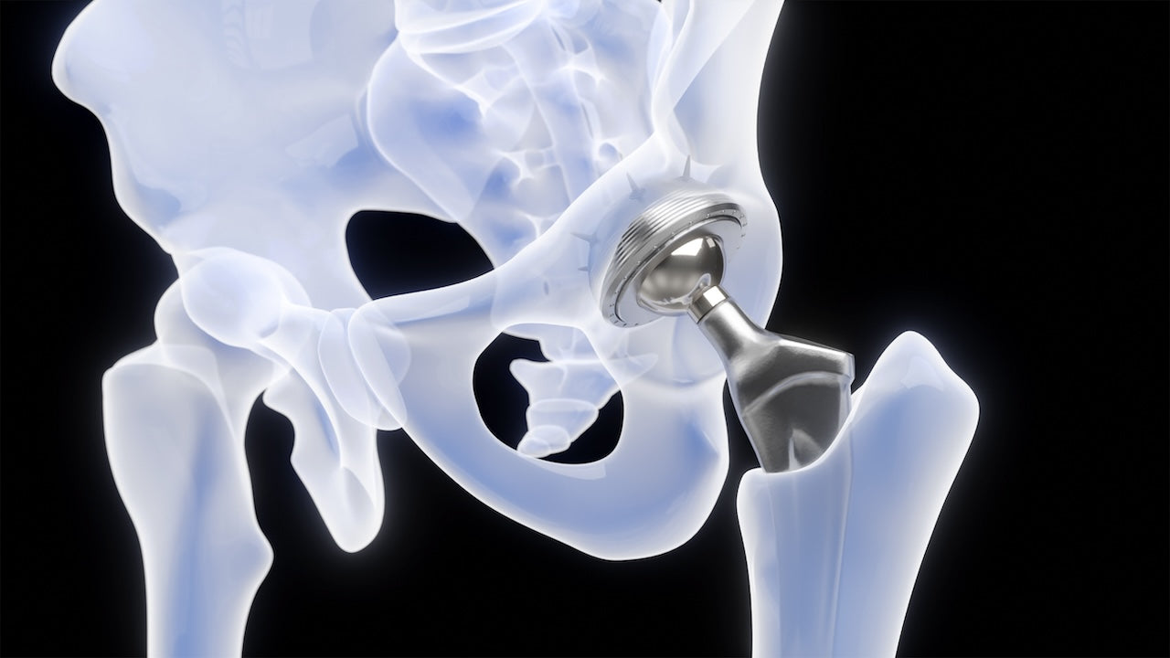 zero-gravity-chair-after-hip-replacement
